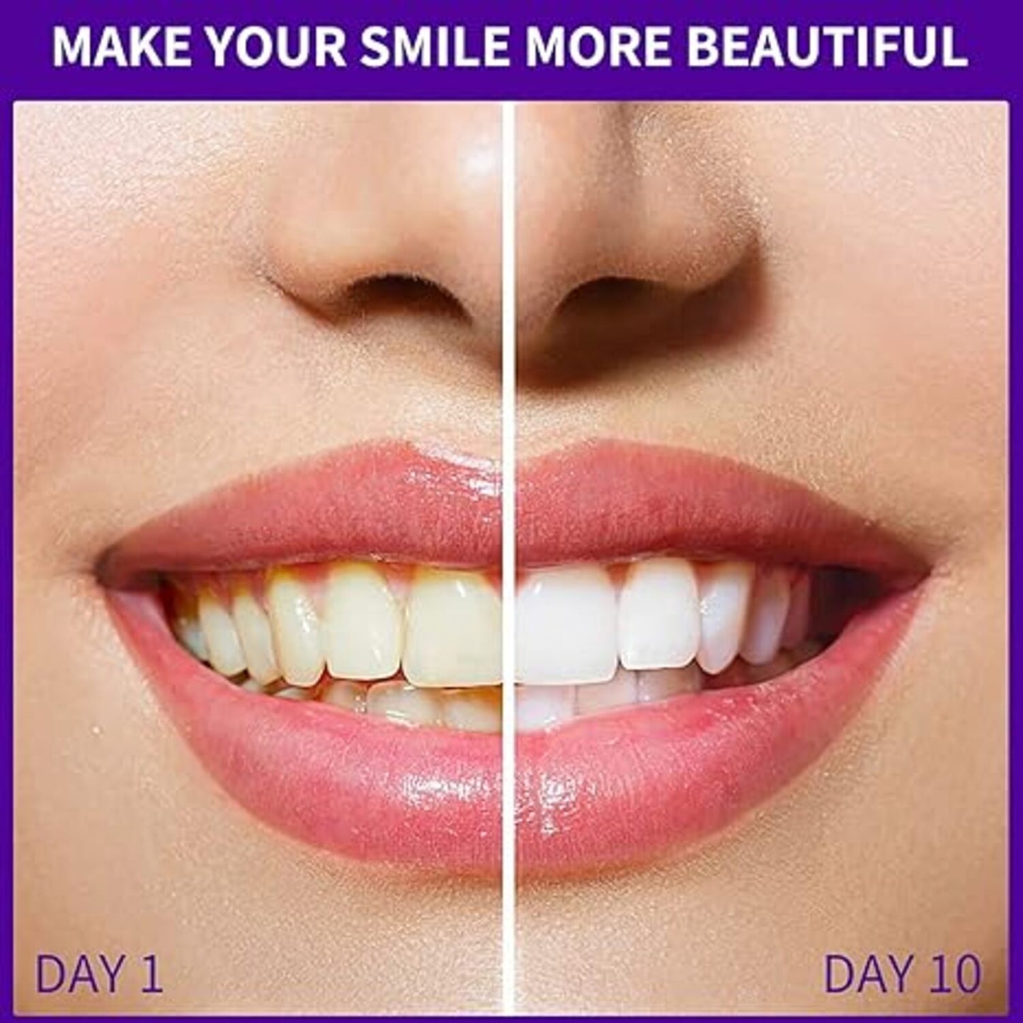 【追跡可能海外メール便】 GlorySmile Purple Foam Toothpaste for Teeth Whitening グローリースマイル パープルフォーム ホワイトニング歯磨き粉 50ml / 1.75oz 紫色のホワイトニング歯磨き粉 ホワイトニング 白い歯
