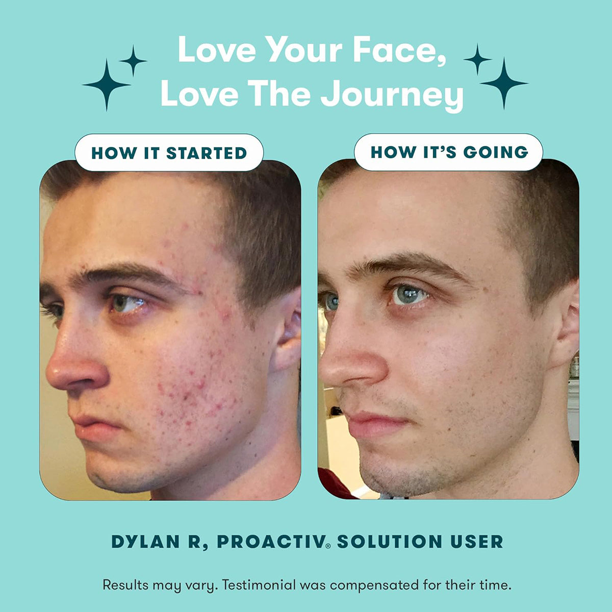 【追跡可能海外メール便】Proactiv 3 Step Acne Skin Care Kit 【アメリカ版】プロアクティブ ニキビ徹底ケアセット