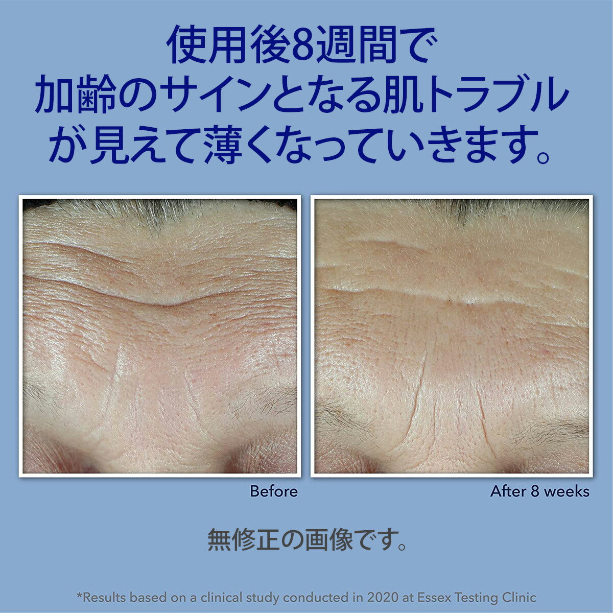 【エクスプレス便】RoC Retinol Correxion Max Daily Hydration Daily Face Moisturizer 1.7oz レチノール・ヒアルロン酸配合クリーム 加齢 予防 エイジングケア