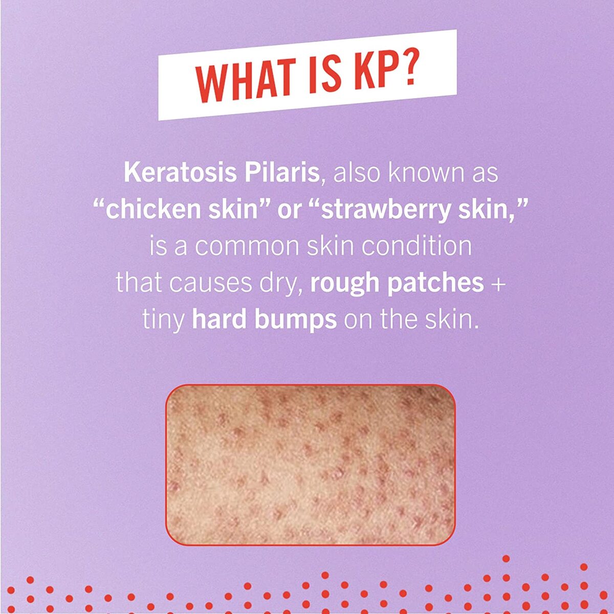 【エクスプレス便】First Aid Beauty KP Bump Eraser Body Scrub Exfoliant for Keratosis Pilaris with 10% AHA 4 ozファーストエイドビューティー 114g 肌のプツプツ解消ボディースクラブ 毛孔性苔癬改善 スクラブ スキンケア 美容