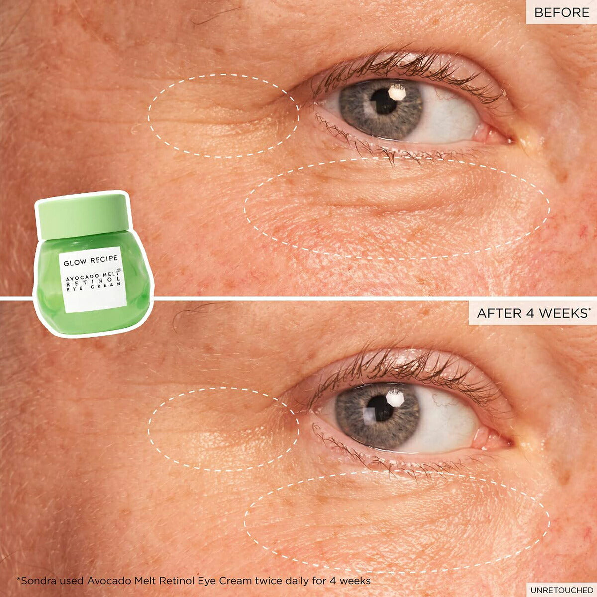 【エクスプレス便】グロウレシピ アボカド メルト レチノール アイクリーム 15ml Glow Recipe Avocado Melt Retinol Eye Cream 目元 引き締め 保湿 レチノール ビタミンE ビタミンC