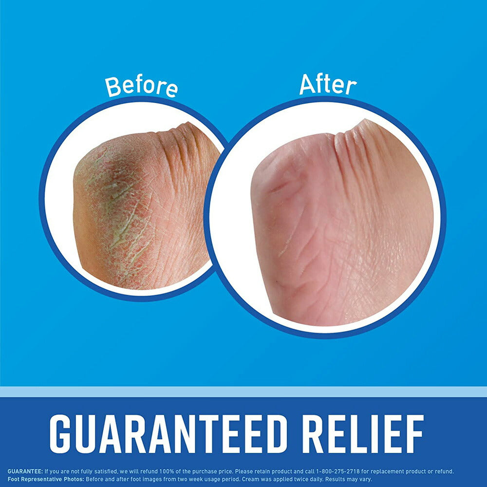 【追跡可能海外メール便】O'Keeffe's Healthy Feet Foot Cream for Extremely Dry , Cracked Feet, 3.2oz Jar オキーフス ヘルシーフィートクリーム フットクリーム