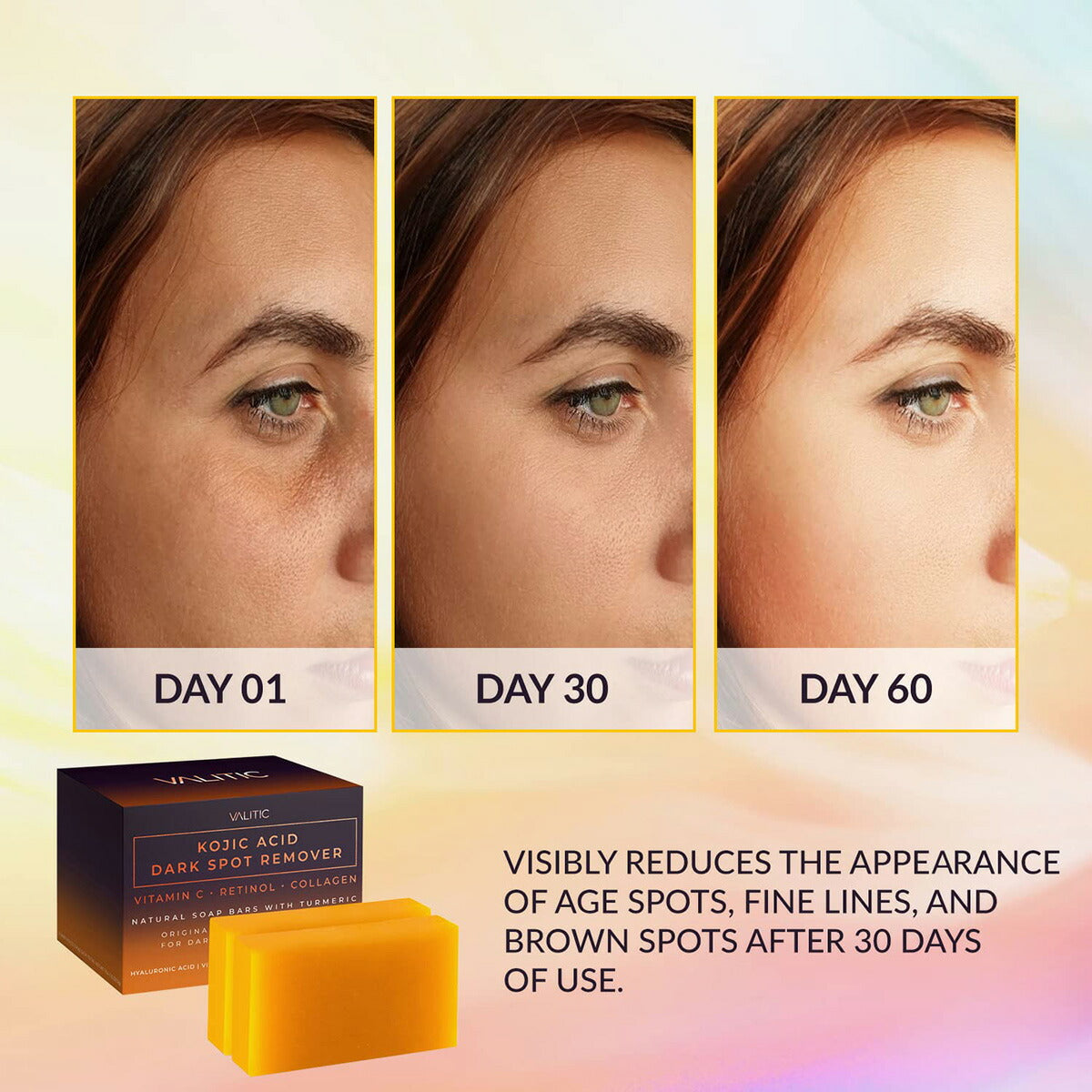 【追跡可能海外メール便】VALITIC Kojic Acid Dark Spot Remover Soap Bars 2pack コウジ酸ダークスポットリムーバー石鹸 2個セット ヒアルロン酸 ビタミンE シアバター レチノール くすみ