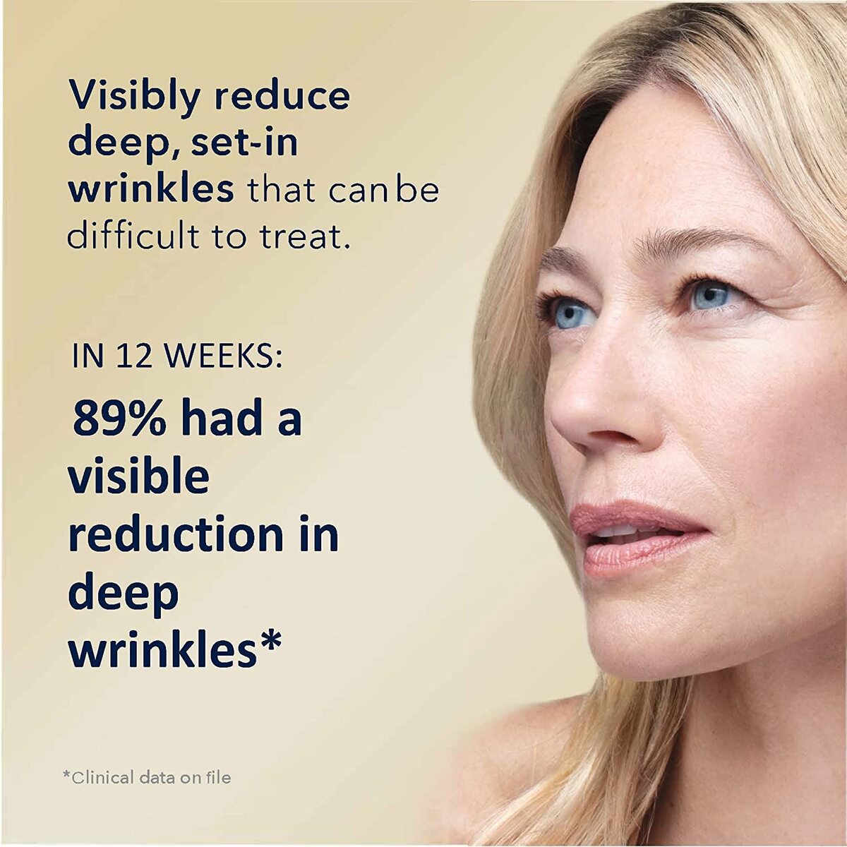【エクスプレス便】【Roc】RoC Retinol Correxion Deep Wrinkle Retinol Face Serum, 1 oz レチノールコレクション ディープリンクル レチノールフェイスセラム