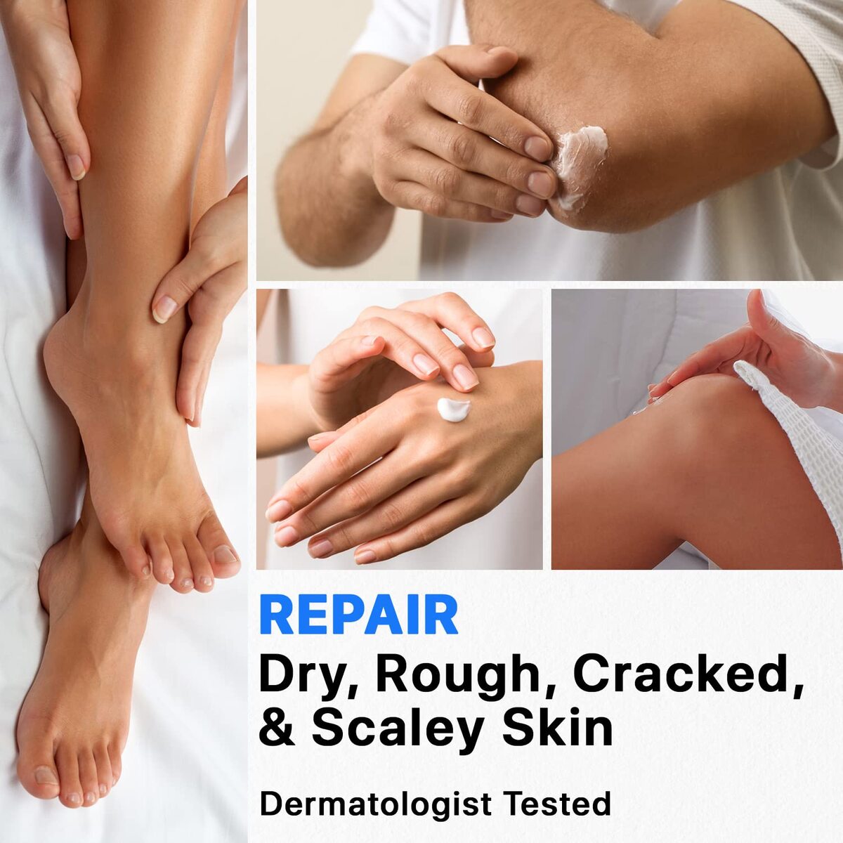 【エクスプレス便】エバネル 尿素クリーム プラス サリチル酸 130g Ebanel Urea Cream 40% plus Salicylic Acid 2% Foot for Dry Cracked Feet Heels Knees Elbows Hands Repair Treatment Moisturizer Corn Callus Dead Skin Remover Toenail Softener Care 4.6oz