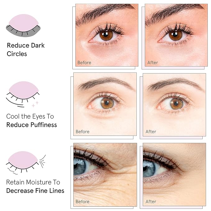 【追跡可能海外メール便】Under Eye Mask Reduce Dark Circles Puffy Eyes Undereye Bags Wrinkles Gel Under Eye Patches Self Care by grace and stella 4.8oz アンダーアイマスク くま ジェルアンダーアイパッチ セルフケア byグレースアンドステラ 6g