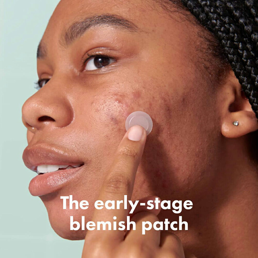 【追跡可能海外メール便】Mighty Patch Micropoint for Blemishes 8 Patches マイティーパッチ マイクロポイント ニキビパッチ 初期段階のニキビや隠れニキビ用のハイドロコロイドニキビスポット 8パッチ ニキビ 肌荒れ