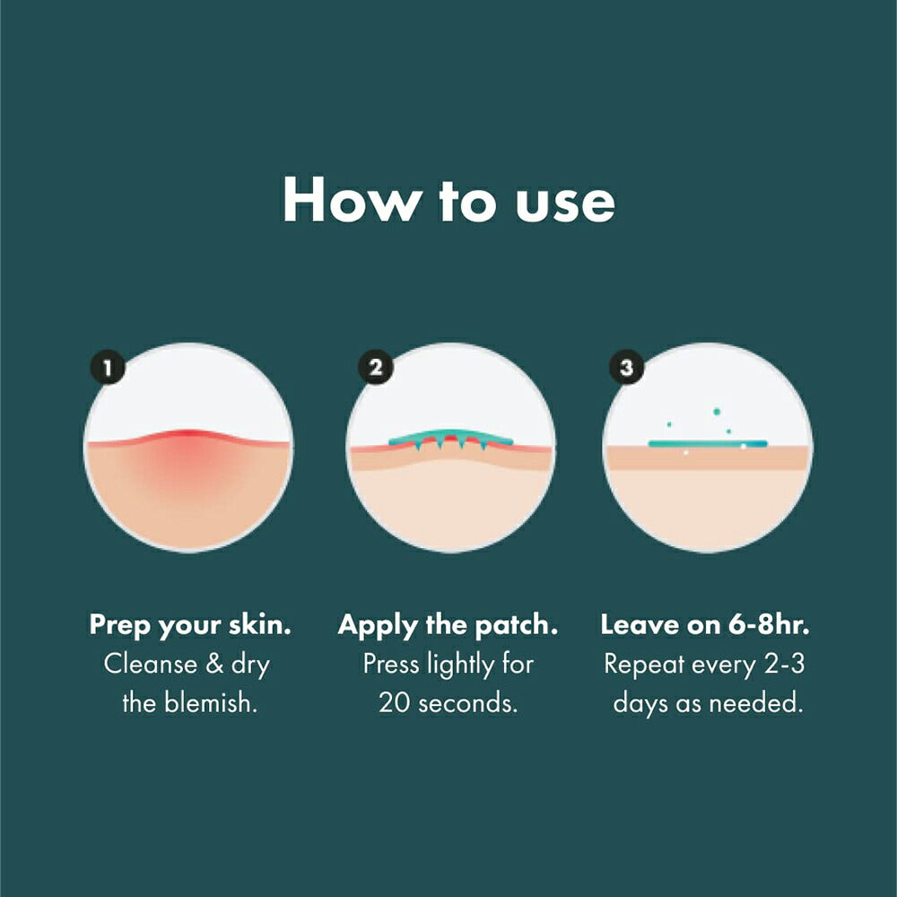 【追跡可能海外メール便】Mighty Patch Micropoint for Blemishes 8 Patches マイティーパッチ マイクロポイント ニキビパッチ 初期段階のニキビや隠れニキビ用のハイドロコロイドニキビスポット 8パッチ ニキビ 肌荒れ