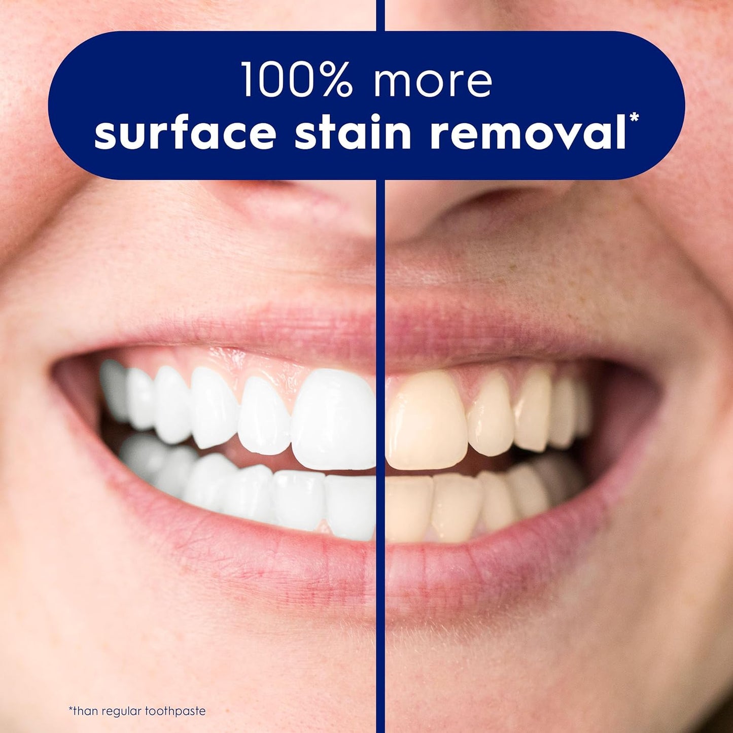 【追跡可能海外メール便】 (大容量 130g)  クレスト 3Dホワイト ブリリアンスミント Crest 3D Brilliance Teeth Whitening Toothpaste Large size 4.6oz  ホワイトニング 白い歯 笑顔