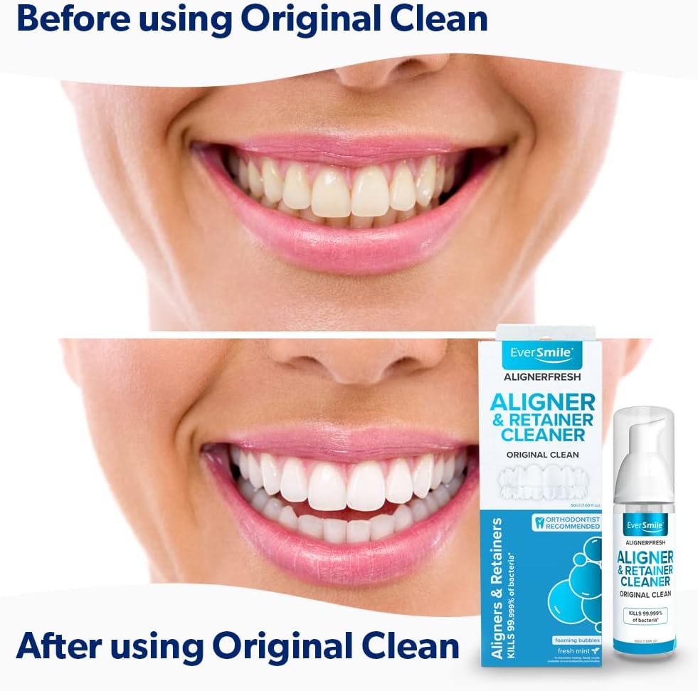 【追跡可能海外メール便】EverSmile AlignerFresh Original Clean 1.69oz エバースマイル アラーナーフレッシュ オリジナル クリーン 50ml  マウスピースクリーナー  ホワイトニング  インビザライン