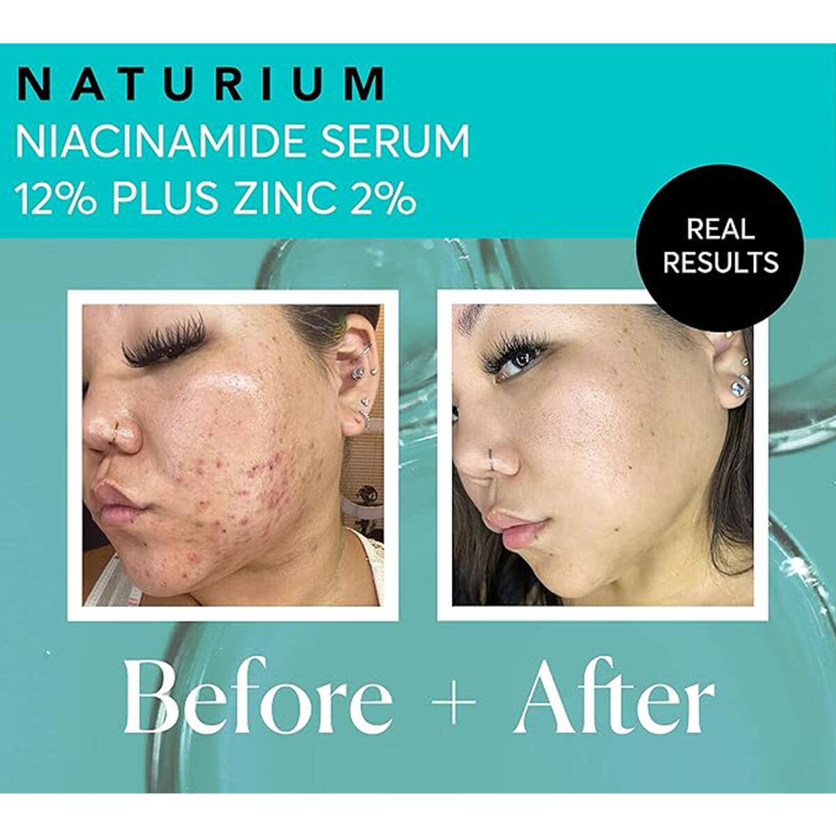 【追跡可能海外メール便】Naturium Niacinamide Face Serum 12% Plus Zinc 2% 1oz ナチュリウム ナイアシンアミド フェイスセラム 30ml 黒ずみ 毛穴 美容液