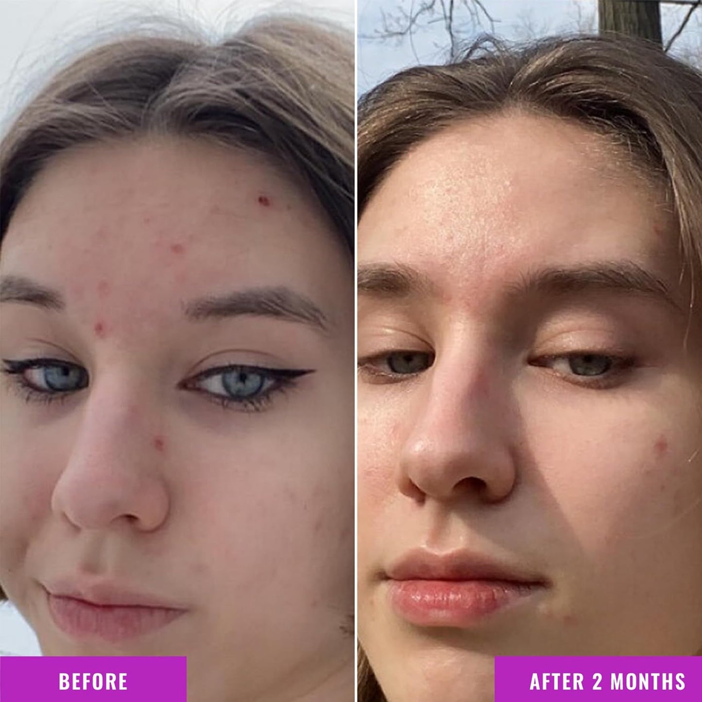 【追跡可能海外メール便】Good Molecules Niacinamide Serum 10% Niacinamide Balancing B3 Facial Serum for Acne 1oz グッドモレキュールズ ナイアシンアミドセラム 10% ナイアシンアミド配合B3フェイシャルセラム(ニキビ用)30ml
