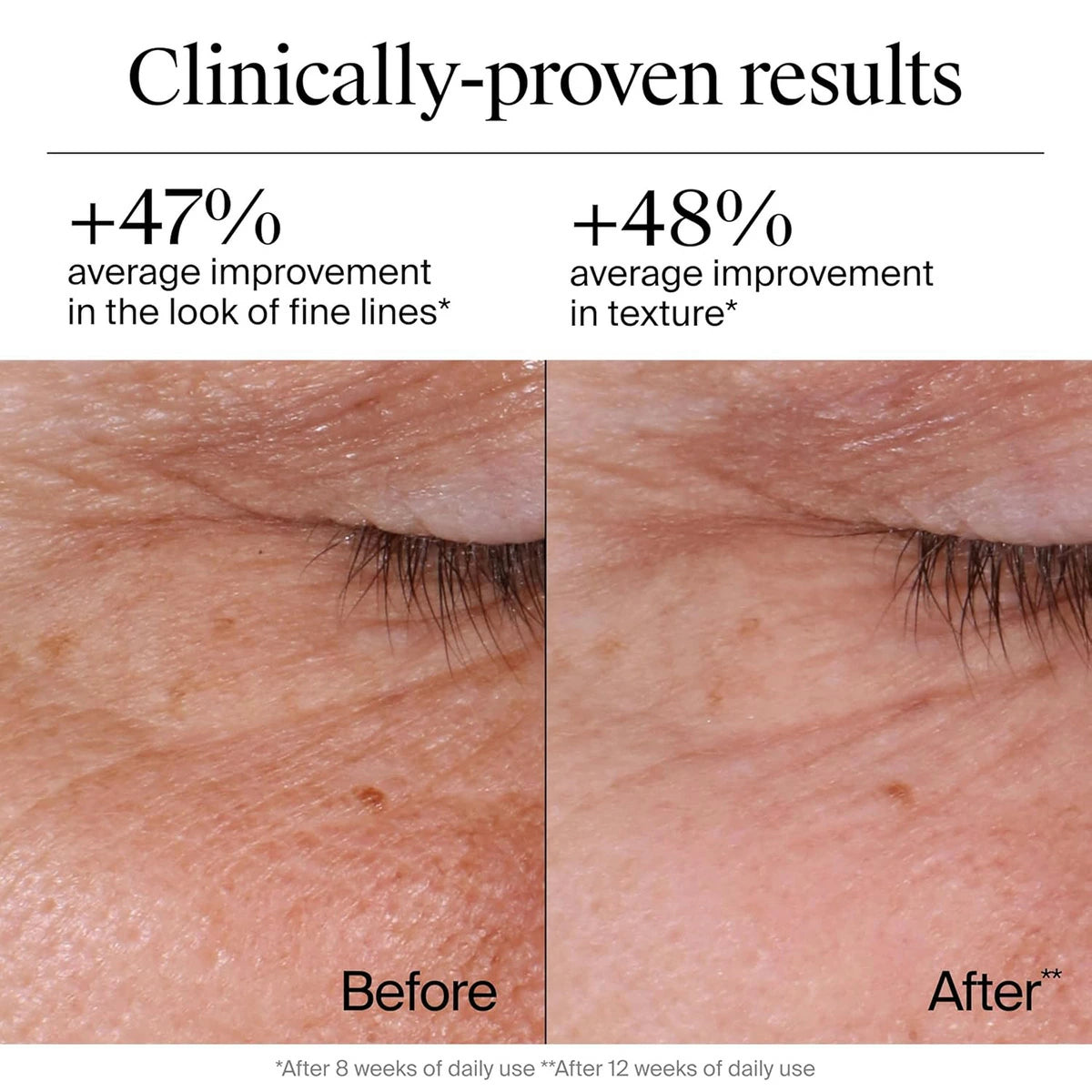 【追跡可能海外メール便】ニュートロジーナ レチノール配合クリーム 1.7oz 48g Neutrogena Rapid Wrinkle Repair Retinol Regenerating Face Cream スキンケア 美容