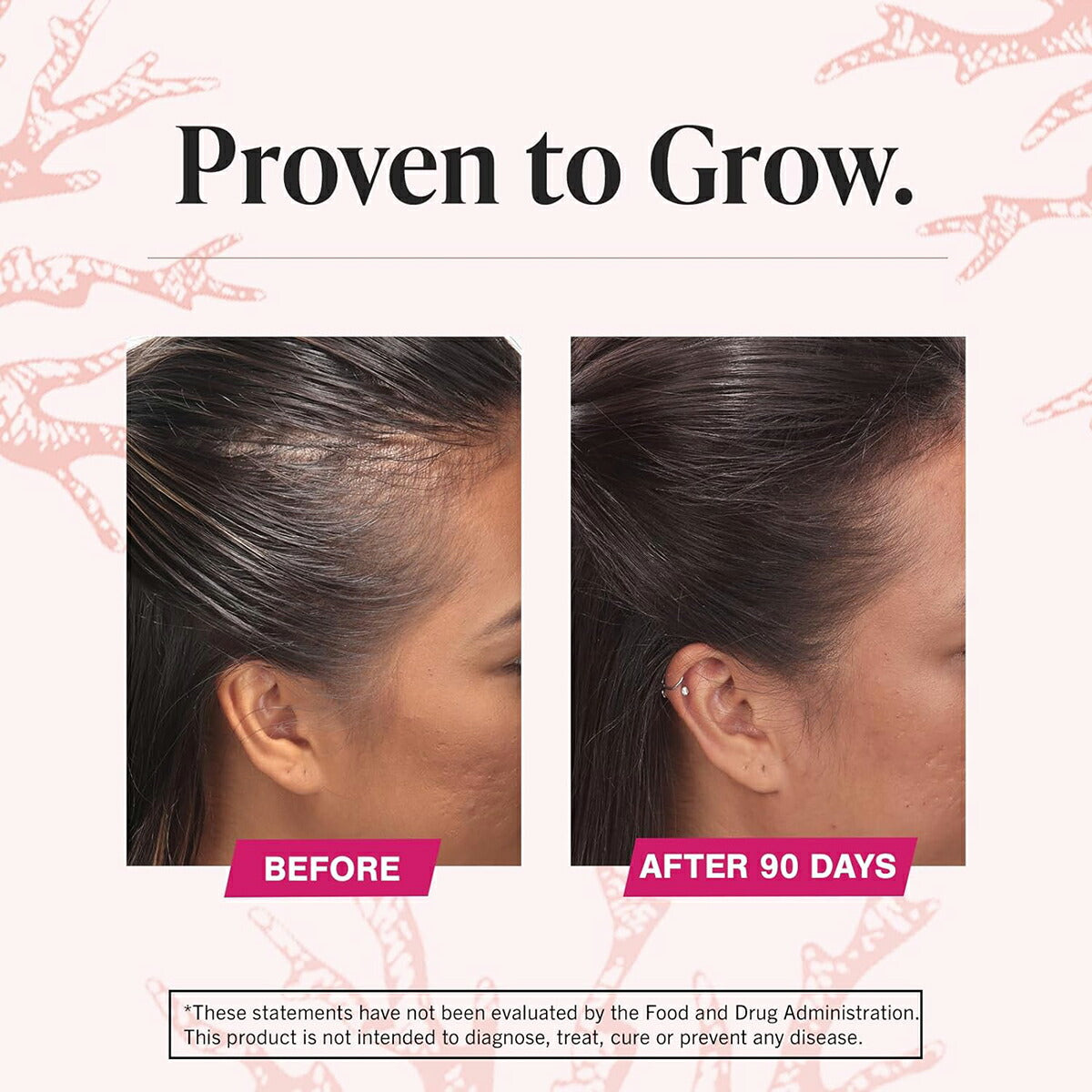 【エクスプレス便】お徳用  Viviscal  女性用  髪の毛用  サプリメント 180錠　3か月分　Viviscal Hair Growth Supplements for Women 180 Count (Pack of 1), 3 Month Supply