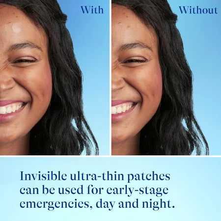 【追跡可能海外メール便】Differin Acne-Prone Skin Patches ディフェリン ニキビパッチ 36枚入り サリチル酸 センテラ