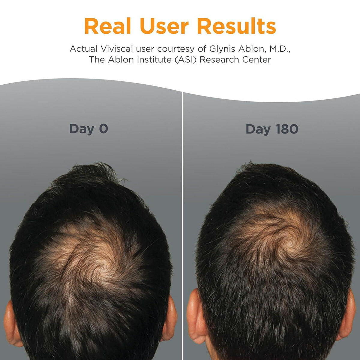 【エクスプレス便】Viviscal 男性用　髪の毛用　サプリメント 60錠　1か月分　Viviscal Hair Growth Supplements for Men's Hair 60 Count (Pack of 1), 1 Month Supply