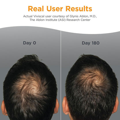 【エクスプレス便】Viviscal 男性用　髪の毛用　サプリメント 60錠　1か月分　Viviscal Hair Growth Supplements for Men's Hair 60 Count (Pack of 1), 1 Month Supply