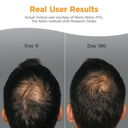 【エクスプレス便】Viviscal 男性用　髪の毛用　サプリメント 180錠　3か月分　Viviscal Hair Growth Supplements for Men's Hair 180 Count (Pack of 1), 3 Month Supply