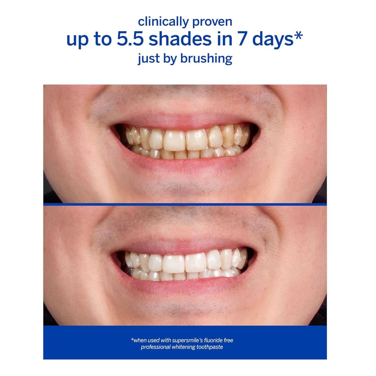 【追跡可能海外メール便】スーパースマイル プロフェッショナル ホワイトニング 歯磨き粉  フッ素不使用  119g オリジナルミント<br> Supersmile Professional Teeth Whitening Toothpaste - Fluoride Free 4.2oz