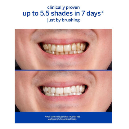 【追跡可能海外メール便】スーパースマイル プロフェッショナル ホワイトニング 歯磨き粉  フッ素不使用  119g オリジナルミント<br> Supersmile Professional Teeth Whitening Toothpaste - Fluoride Free 4.2oz