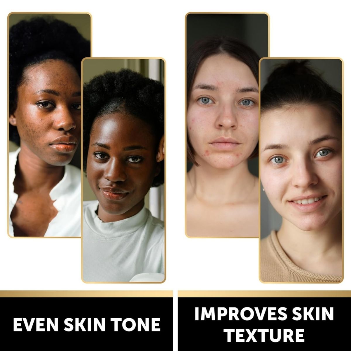 【エクスプレス便】 VALITIC  チャコール＆コウジ酸 ターメリック ダークスポットリムーバー ブラックソープ 2個セット VALITIC Charcoal Kojic Acid Turmeric Black Soap Bar Dark Spot Remover for Body or Face Wash 2 Pack 石鹸 くすみ ヒアルロン酸 ビタミンE