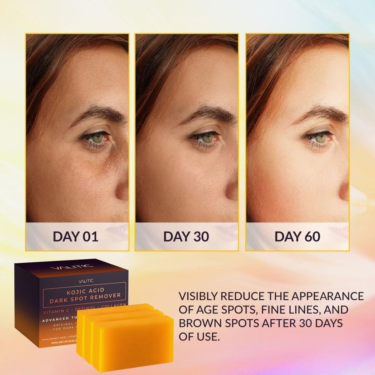 【エクスプレス便】 VALITIC コウジ酸ダークスポットリムーバー石鹸　3個セット VALITIC Kojic Acid Dark Spot Remover Soap Bars 3pack ヒアルロン酸　ビタミンE　シアバター　レチノール　くすみ