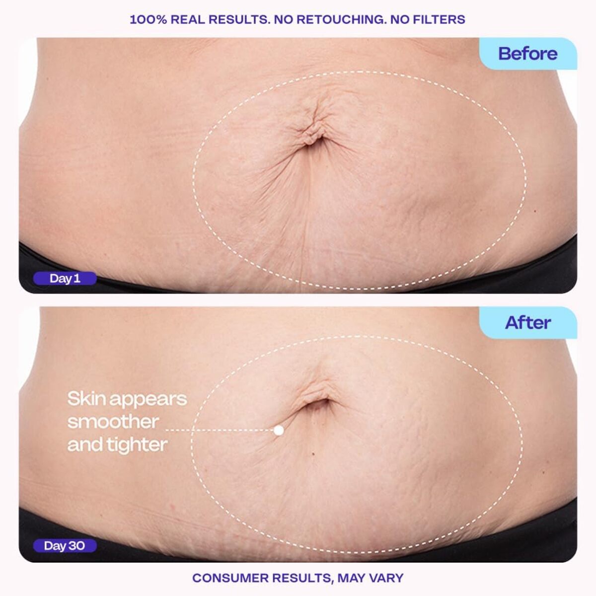 【エクスプレス便】goPure タイテン アンド スムース ベリー クリーム ゴーピュア Tighten & Smooth Belly Cream 4.25oz/125ml お腹引き締め リフトアップ ハリ ケア ボディクリーム