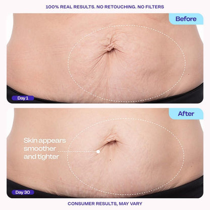 【エクスプレス便】goPure タイテン アンド スムース ベリー クリーム ゴーピュア Tighten & Smooth Belly Cream 4.25oz/125ml お腹引き締め リフトアップ ハリ ケア ボディクリーム