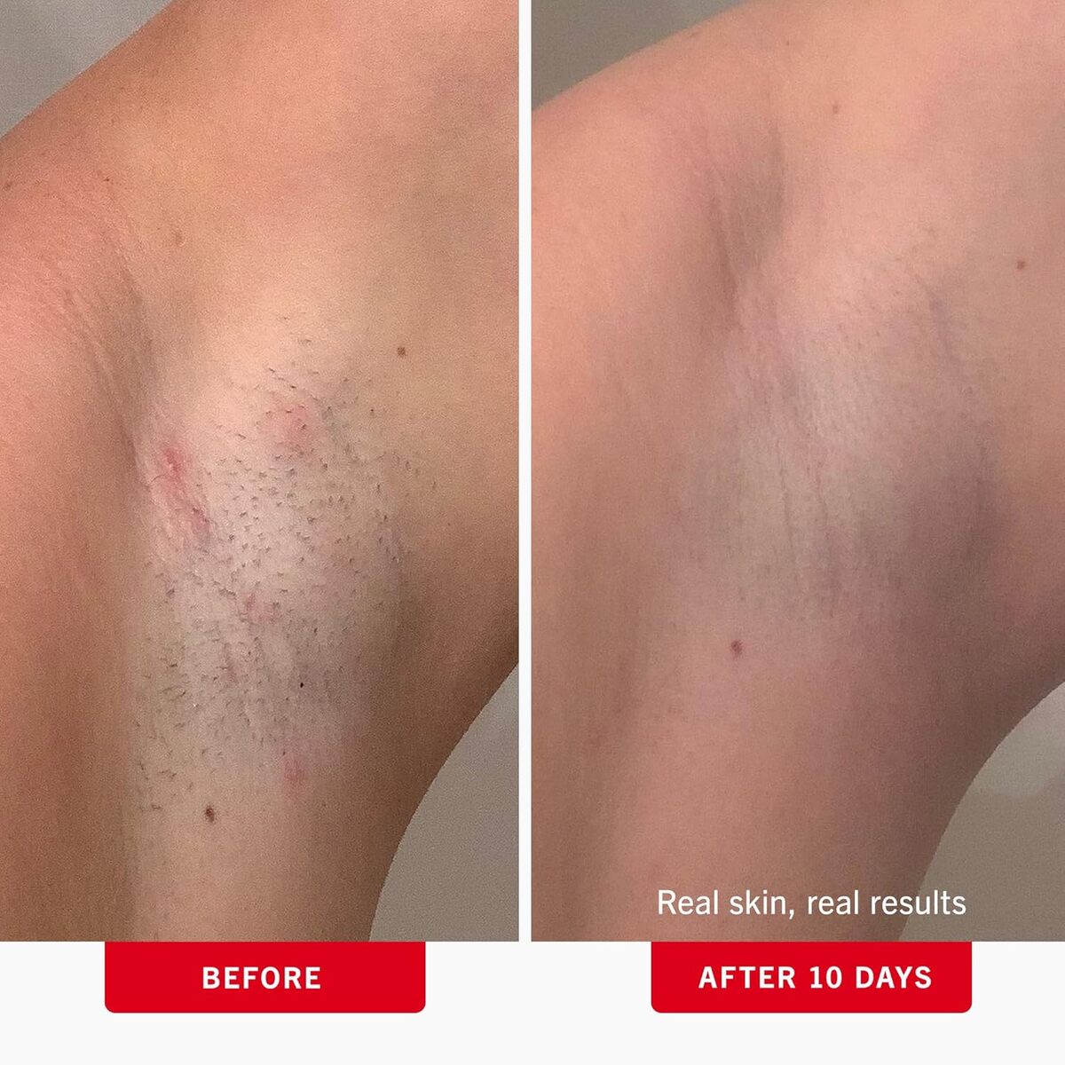 【エクスプレス便】 First Aid Beauty BHA + AHA配合の埋没毛パッド ファーストエイドビューティー Ingrown Hair Pads with BHA + AHA 28Pads 0.99oz/約29ml 拭き取りパット 毛穴 ブツブツ ケア