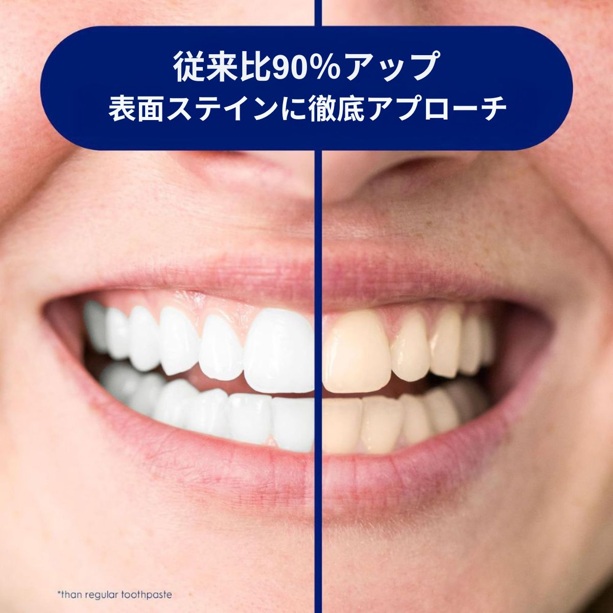 【エクスプレス便】最新版 Crest 3D White Advanced Radiant Mint 3.3oz　pack of 6 　エクスプレス便　【お得な6本セット】　クレスト３Dホワイト　ラディアントミント 93g / 3.3oz  6本 ホワイトニング歯磨き粉　ホワイトニング　白い歯