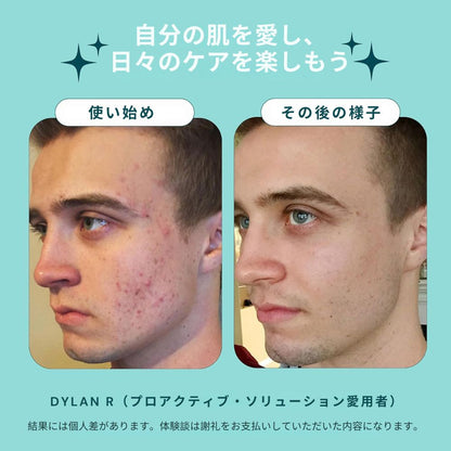 【追跡可能海外メール便】Proactiv 3ステップ アクネ ケアセット 30日分 プロアクティブ  3 Step Acne Skin Care Kit 洗顔 化粧水 ポットジェル スキンケアキット