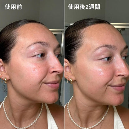 【追跡可能海外メール便】 Dermisa Skin Fade Cream 1.78oz デルミサ スキンフェイドクリーム 50g　たっぷり50g