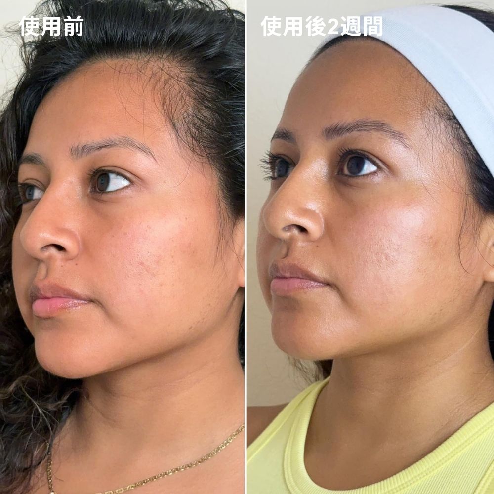 【追跡可能海外メール便】 Dermisa Skin Fade Cream 1.78oz デルミサ スキンフェイドクリーム 50g　たっぷり50g