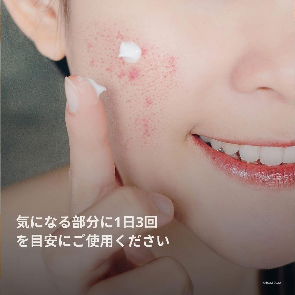 【追跡可能海外メール便】 Neutrogena ラピッドクリア スタボーン アクネ スポットトリートメント ジェル 1oz ニュートロジーナ Neutrogena Rapid Clear Stubborn Acne Spot Treatment Gel 1 oz ニキビケア 即効ケア