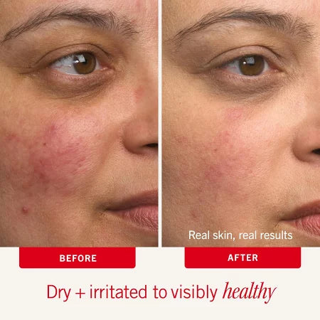 【エクスプレス便】First Aid Beauty Ultra Repair Cream 6oz ファーストエイドビューティー ウルトラリペアークリーム 170.1g  保湿クリーム　乾燥肌