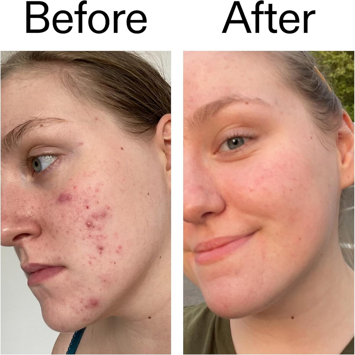 【エクスプレス便】The INKEY List 10%グリコール酸トナー ザインキーリスト 10% Glycolic Acid Toner 3.4oz/100ml 角質除去 毛穴ケア 黒ずみ 化粧水